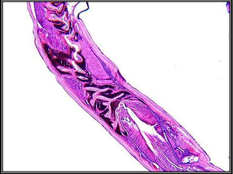 H&E stain on a nematode (worm)